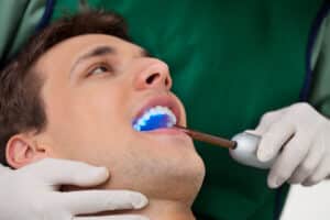 Young man having his smile fixed using dental bonding treatment