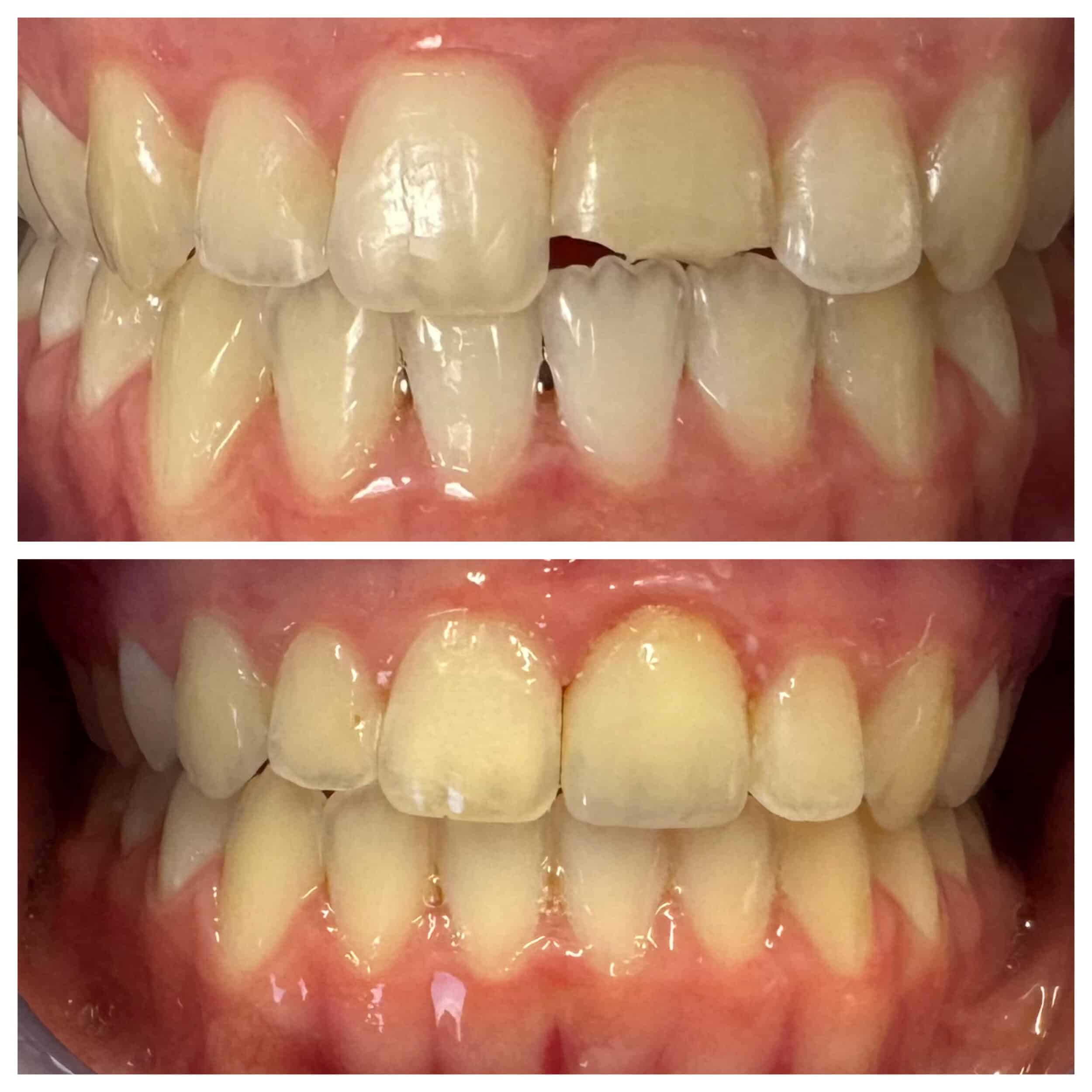 Cosmetic Restorative Dentistry