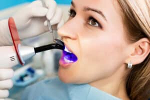 Woman with a UV light in her mouth, having cosmetic dentistry performed via dental bonding